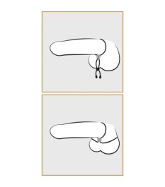 Penismanschetten „Tokio Cockrings“ mit Rillen und Noppen